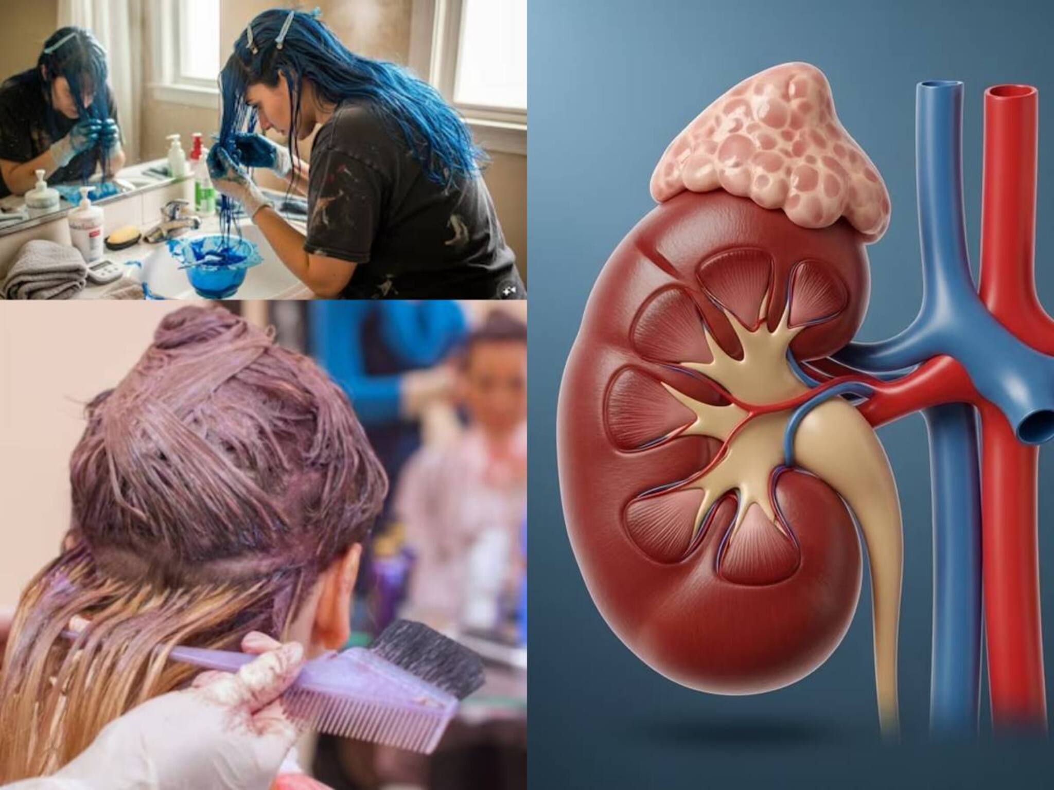 Hair Colour causing Kidney Disease: হেয়ার কালার কিডনির জন্য বিষাক্ত? চুলে রং দিলেই রোগে ঝাঁঝরা কিডনি? কিডনির অসুখের লক্ষণ কী কী? জানুন