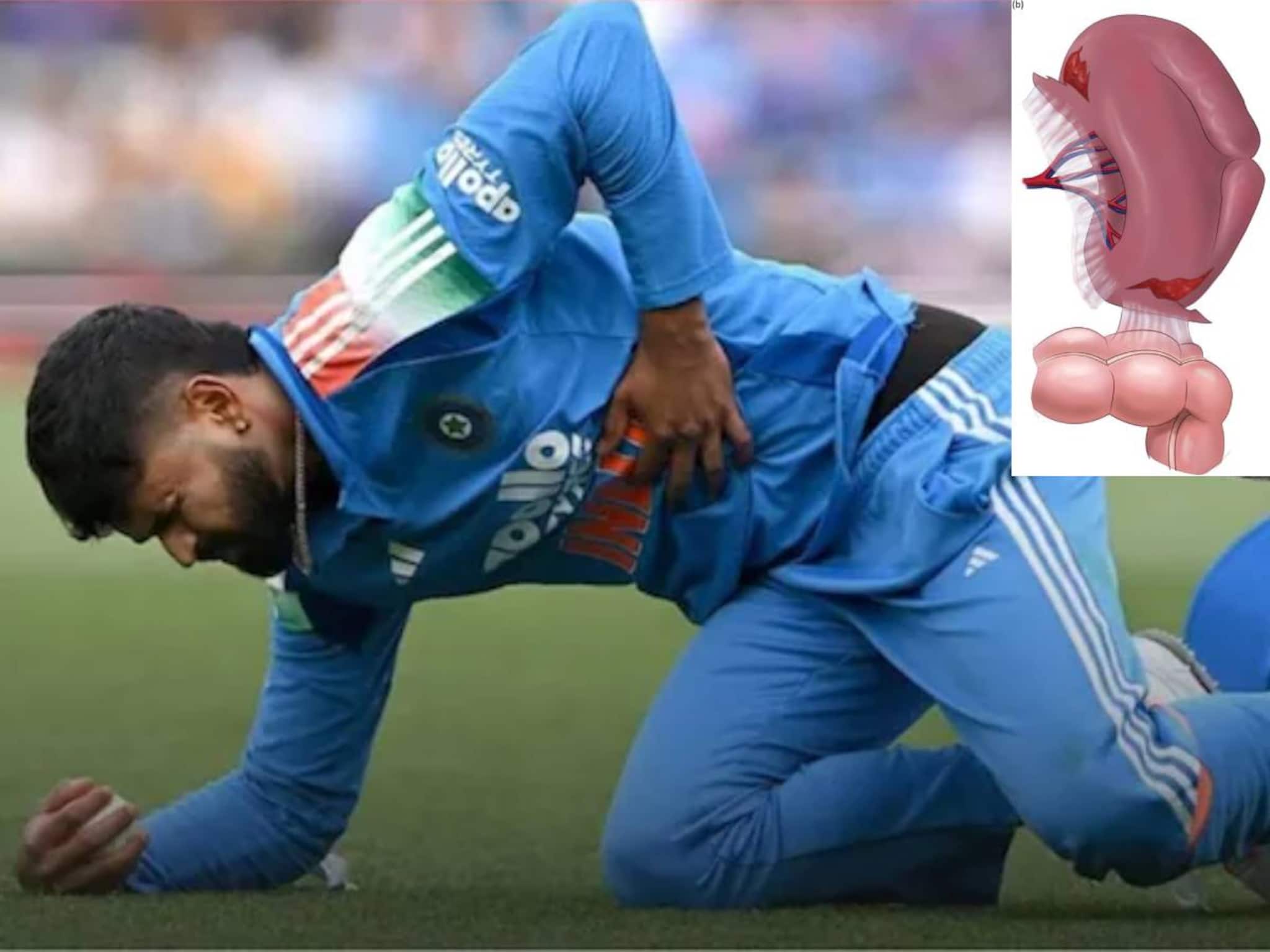 Shreyas Iyer’s Spleen Injury: শরীরের ভিতরে রক্তক্ষরণ! হতে পারত চরম পরিণতি! ‘এই’ অঙ্গে ভয়ঙ্কর আঘাত লাগে ক্রিকেটার শ্রেয়স আইয়ারের! জানুন বিশদে