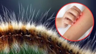 শরীরের সংস্পর্শে এলে বহুবিধ ক্ষতির কারণ হয়ে ওঠে