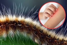 Caterpillar Sting Home Remedies: দুর্গন্ধে বমি উঠে আসবে! অথচ এটাই ১ চিমটে লাগালে শুঁয়োপোকার কাঁটার জ্বালাপোড়ায় মিলবে আরাম!