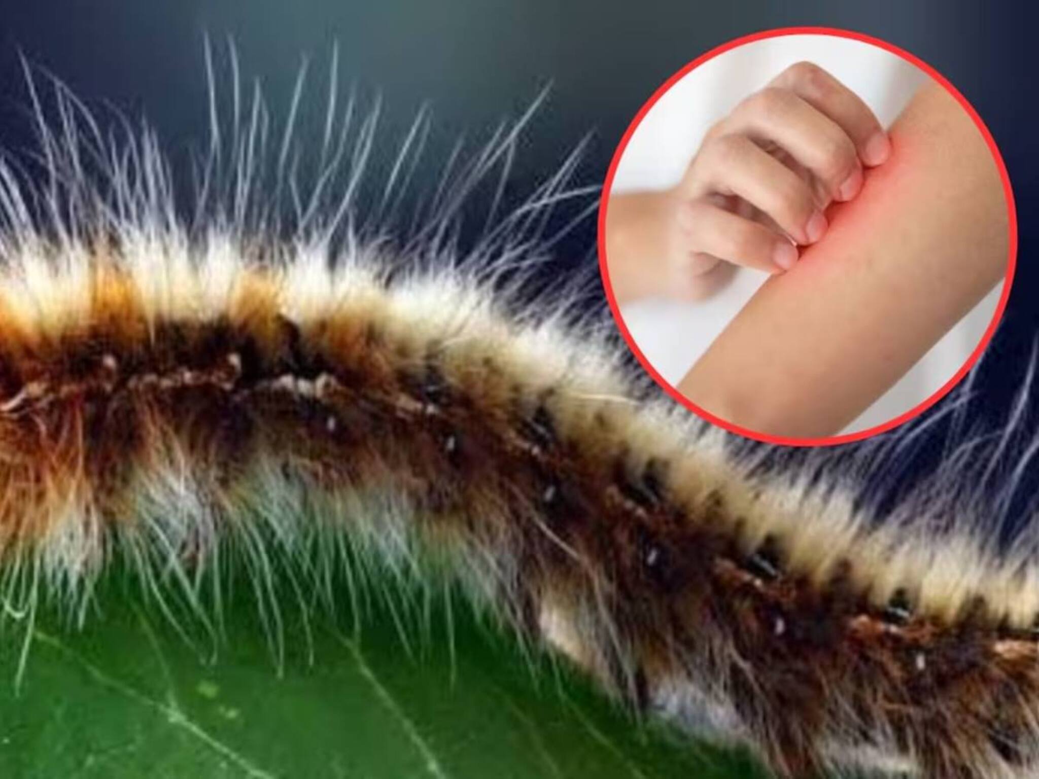 Caterpillar Sting Home Remedies: দুর্গন্ধে বমি উঠে আসবে! অথচ এটাই ১ চিমটে লাগালে শুঁয়োপোকার কাঁটার জ্বালাপোড়ায় মিলবে আরাম!