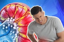 Kidney Disease Symptoms: কিডনি খারাপ হওয়ার ‘৭’ লক্ষণ কী কী? ছুঁয়েও দেখবেন না এই ‘৩’ খাবার! তিলে তিলে ফুটিফাটা হবে কিডনি!