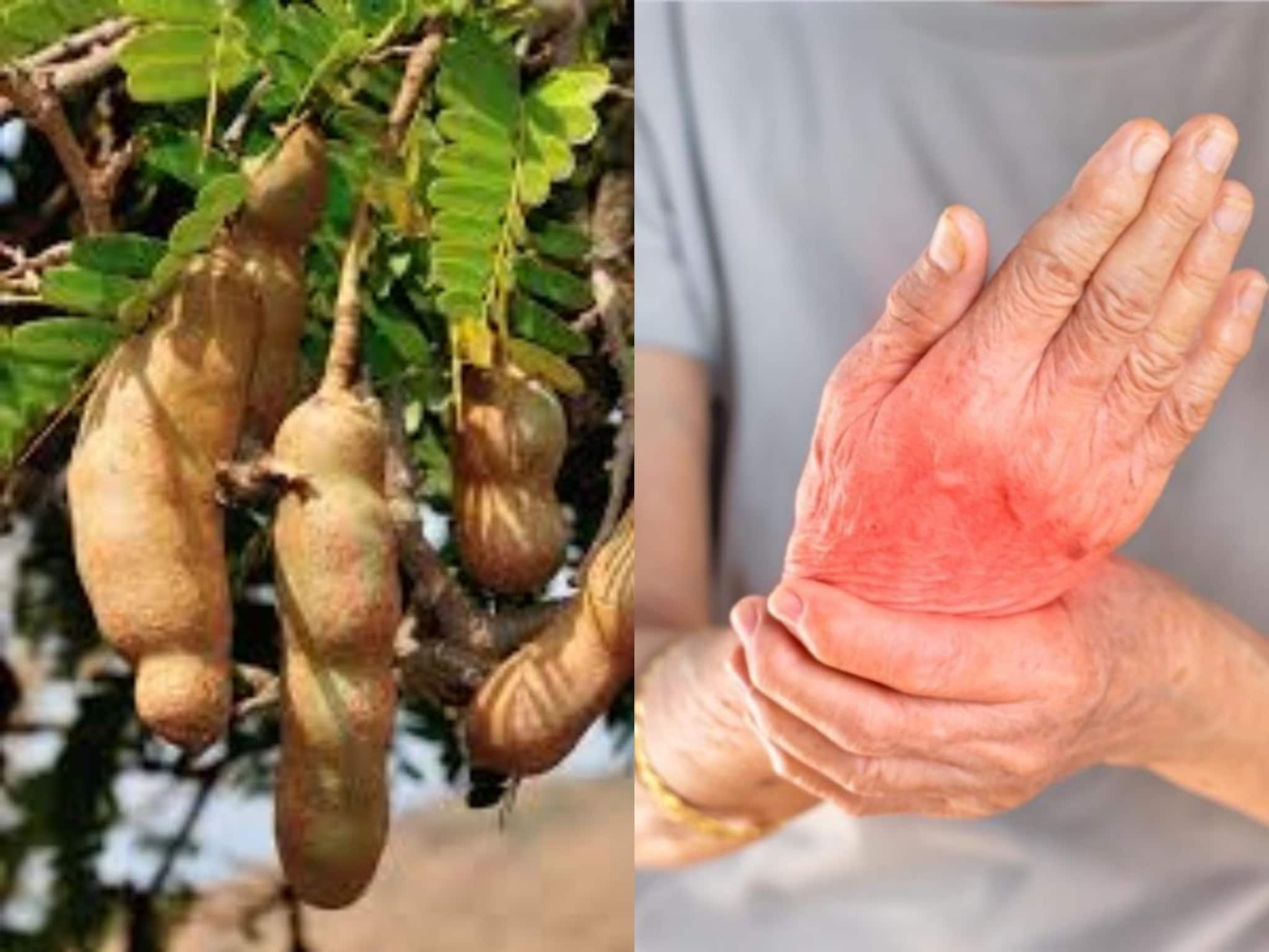 Tamarind and Arthritis: তেঁতুল বীজেই কি লুকিয়ে আছে বাতের ব‍্যথার প্রাকৃতিক ওষুধ? কী বলছে বিশেষজ্ঞরা