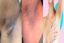 কালো বগল নিয়ে লজ্জা? ইচ্ছা হলেও স্লিভলেস পরতে পারেন না? রান্নাঘরের ২ উপাদানে উধাও দাগ-ছোপ