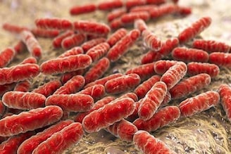 শুধুই গ্যাস-অ্যাসিডিটি নয়,এই লক্ষণগুলোও জানান দেয় শরীরে খারাপ ব্যাকটেরিয়া কিলবিল করছে