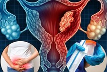 শুধু পিরিয়ডস শেষে করুন ‘এটা’...মারণ সারভাইক্যাল ক্যানসার হবে ‘নির্মূল’! কীভাবে?