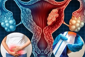 শুধু পিরিয়ডস শেষে করুন ‘এটা’...মারণ সারভাইক্যাল ক্যানসার হবে ‘নির্মূল’! কীভাবে?