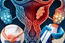 Cancer: শুধু পিরিয়ডস শেষে করুন ‘এটা’...মারণ সারভাইক্যাল ক্যানসার হবে ‘নির্মূল’! কীভাবে? পরামর্শ দিলেন চিকিত্সক