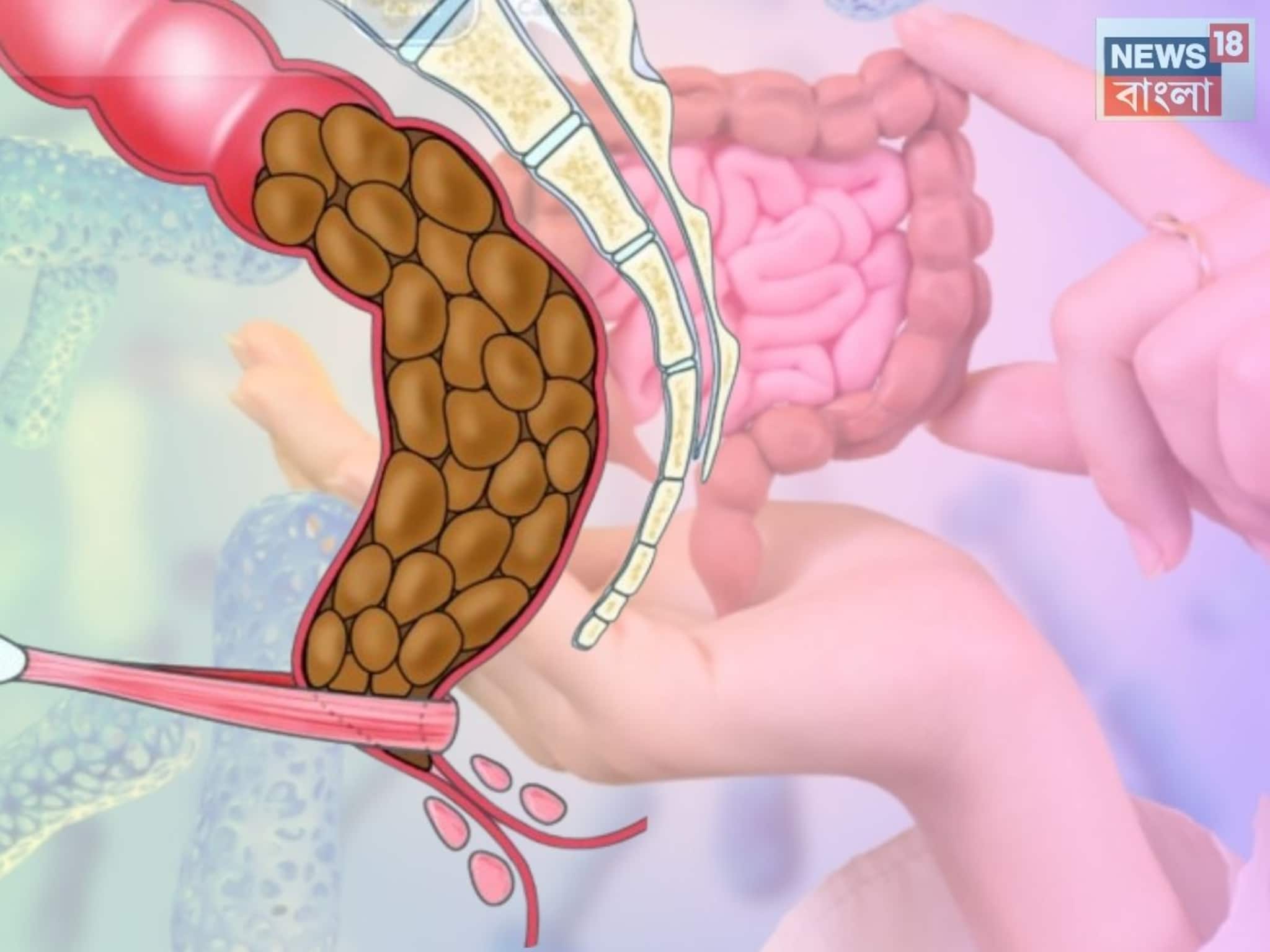 Panta Bhat for Gut Health: এত বড়লোক হয়েও বলিউড স্টার খান পান্তা ভাত! যুগ যুগ ধরে পেট সাফ রাখার আসল সিক্রেট, চিরদিনের মতো গায়েব হবে কোষ্ঠকাঠিন্য