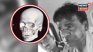 চোখের নীচে গুরুতর আঘাত, ICU-তেই রয়েছেন খগেন! বিজেপি সাংসদকে কি নিয়ে যাওয়া হবে দিল্লিতে?