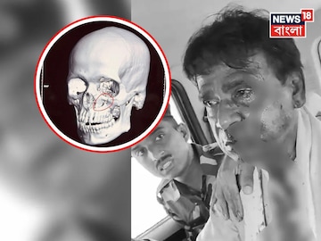 চোখের নীচে গুরুতর আঘাত, ICU-তেই রয়েছেন খগেন! বিজেপি সাংসদকে কি নিয়ে যাওয়া হবে দিল্লিতে?