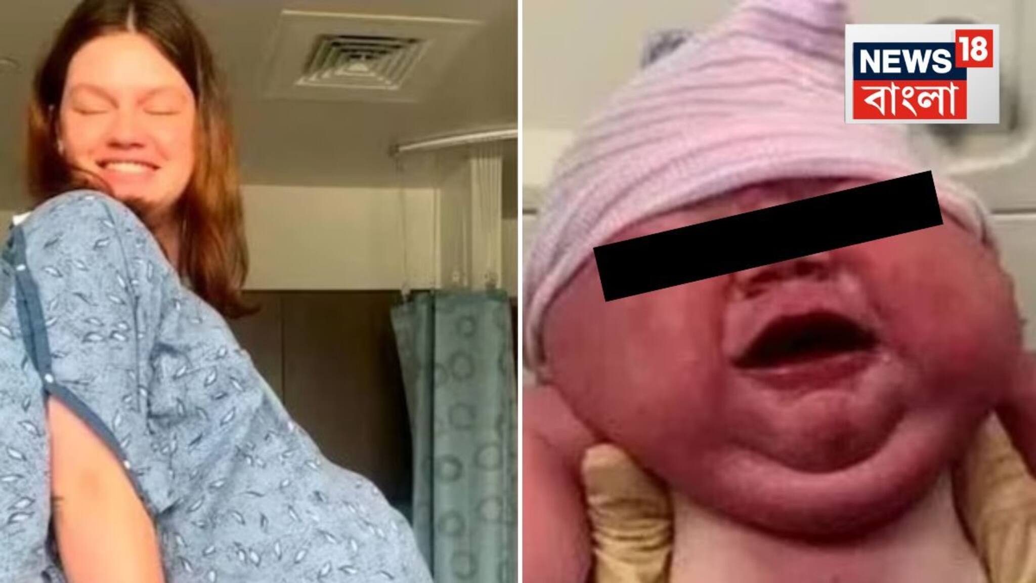 বেবি বাম্প ছিল বিরাট, মহিলার পেট থেকে জন্ম নিল 'বাহুবলী'... ভেঙে গেল সব 'রেকর্ড'! চোখ কপালে উঠল চিকিৎসকদেরও