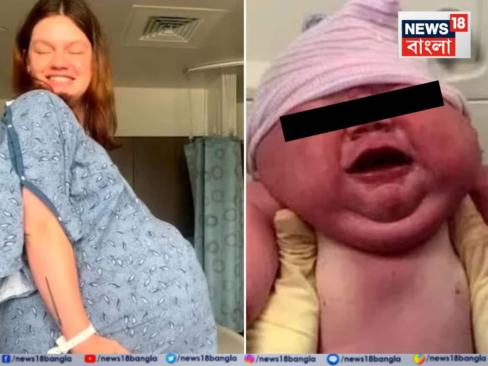 বেবি বাম্প ছিল বিরাট, মহিলার পেট থেকে জন্ম নিল 'বাহুবলী'... ভেঙে গেল সব 'রেকর্ড'! চোখ কপালে উঠল চিকিৎসকদেরও