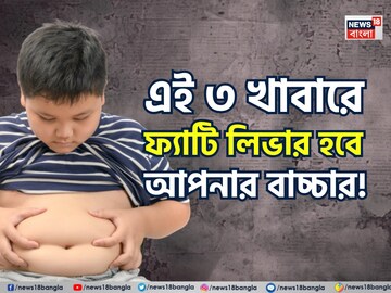 তিলে তিলে পচবে লিভার! বারোটা বাজবে শরীরের! এই ৩ খাবারে ফ্যাটি লিভার হবে আপনার বাচ্চার