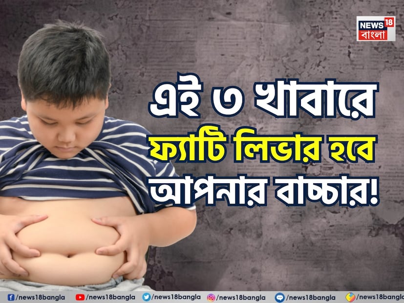 এক সময় শিশু কিশোরদের মধ্যে ফ্যাটি লিভার রোগ ভাবাই যেত না৷ কিন্তু এখন এই অসুখ প্রাপ্তবয়স্কদের পাশাপাশি হানা দিচ্ছে ছোটদের শরীরেও৷ কার্যত দেখা দিচ্ছে নীরব মহামারি হয়ে৷ জনস্বাস্থ্যের ক্ষেত্রে প্রধান উদ্বেগের বিষয়ে পরিণত হয়েছে শৈশবের স্থূলতা, খারাপ খাদ্যাভ্যাস এবং শারীরিক কার্যকলাপের অভাব।