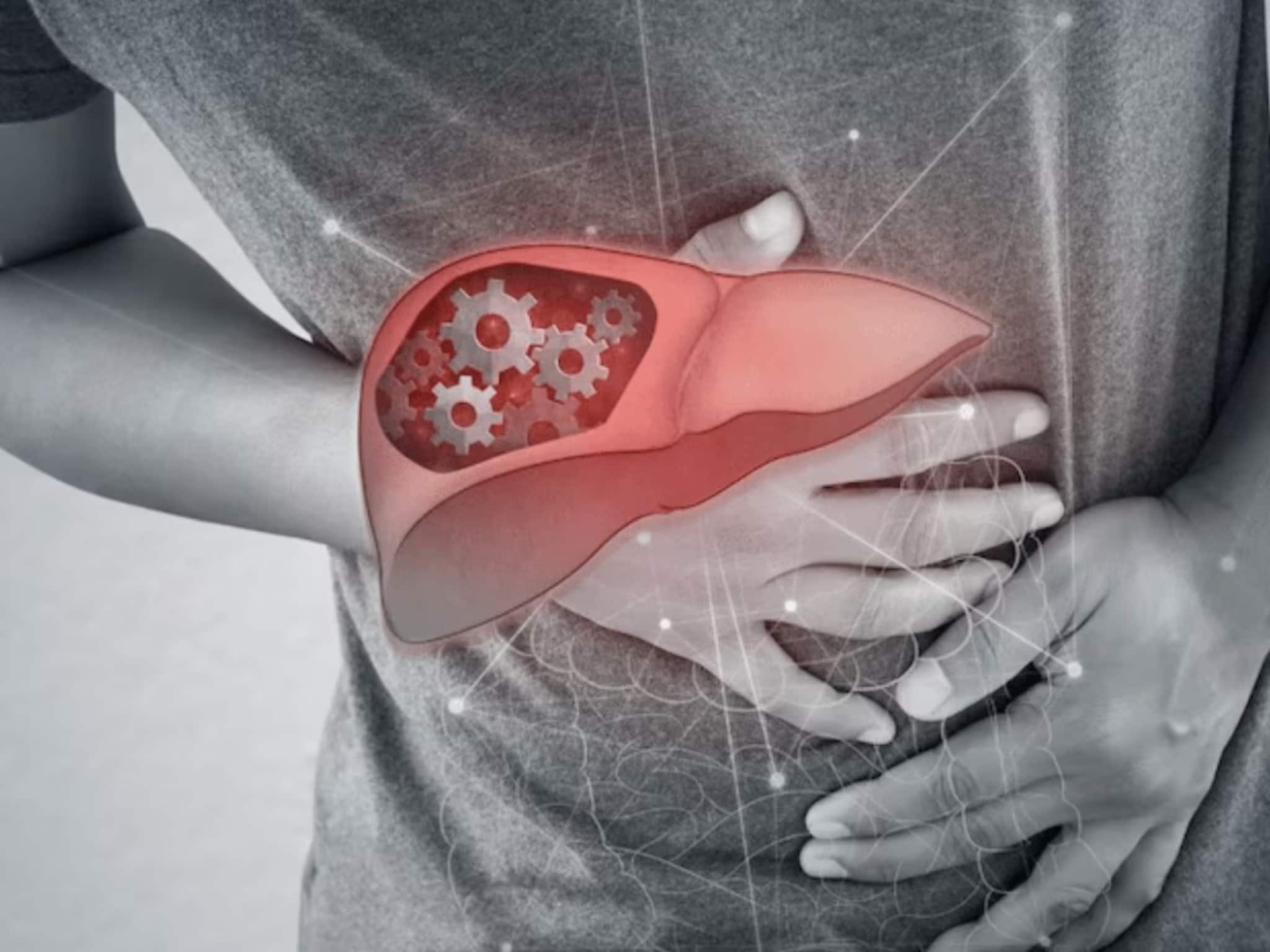 Superfood For Liver and Cancer: ক্যানসার রুখতে সুস্থ রাখতে হবে লিভার,গবেষণায় প্রমাণিত, এই ৫ 'সুপারফুড' লিভার ভাল রাখে, বিনাষ করে কর্কট-কোষ