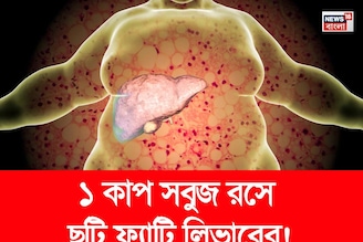 পচবে না লিভার! নোংরা চর্বি গলগলিয়ে সাফ! ১ কাপ সবুজ রসে ফ্যাটি লিভারের ছুটি!