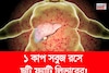 পচবে না লিভার! নোংরা চর্বি গলগলিয়ে সাফ! ১ কাপ সবুজ রসে ফ্যাটি লিভারের ছুটি!