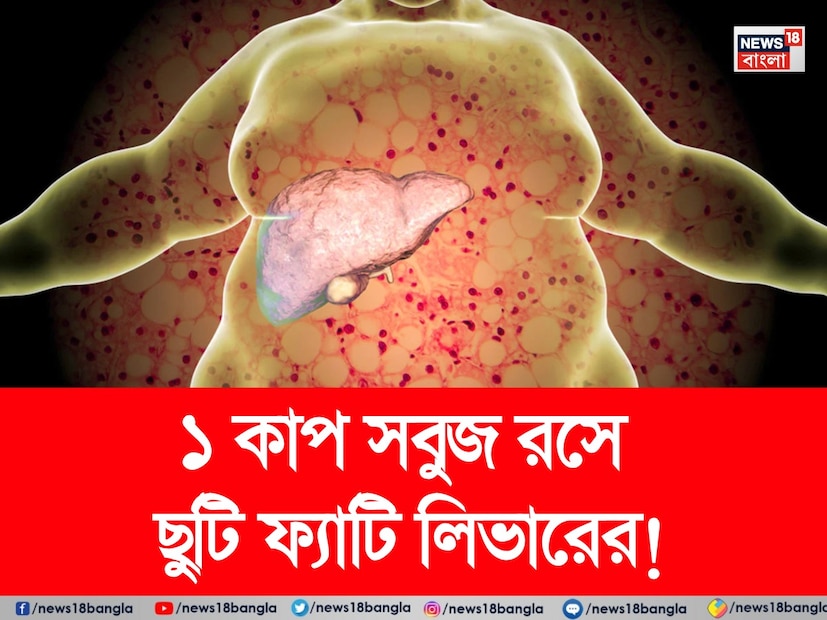 ফ্যাটি লিভার রোগ এমন একটি রোগ যা নীরবে লিভারকে ফাঁপা করতে শুরু করে। এটি একটি গুরুতর সমস্যা যা ধীরে ধীরে বেড়ে যায়। একটি সমীক্ষা অনুসারে, ভারতে প্রতি চারজন প্রাপ্তবয়স্কের মধ্যে একজন ফ্যাটি লিভার ডিজিজের শিকার। সমস্যা হল যে বেশিরভাগ মানুষ জানেনই না যে তাদের এই রোগ আছে। 