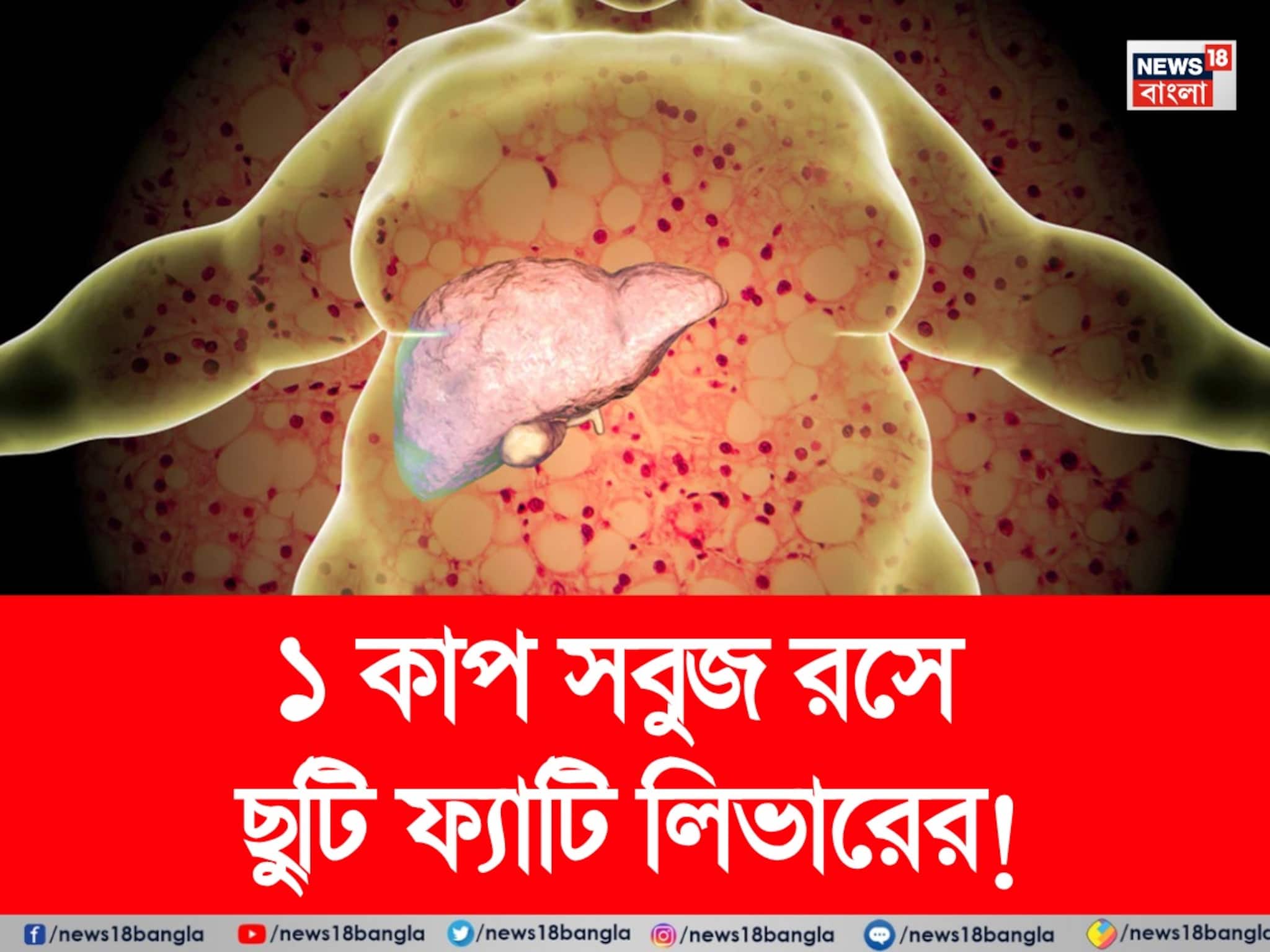 Fatty Liver Home Remedies: পচবে না লিভার! নোংরা চর্বি গলগলিয়ে সাফ! ১ কাপ সবুজ রসে ফ্যাটি লিভারের ছুটি!