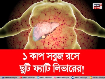 পচবে না লিভার! নোংরা চর্বি গলগলিয়ে সাফ! ১ কাপ সবুজ রসে ফ্যাটি লিভারের ছুটি! পচবে না লিভার! নোংরা চর্বি গলগলিয়ে সাফ! ১ কাপ সবুজ রসে ফ্যাটি লিভারের ছুটি!
