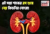 সস্তা এই শাকের রসই শুষে নেয় কিডনির নোংরা! সারে অ্যানিমিয়া! সারিয়ে দেয় পেটের রোগ!