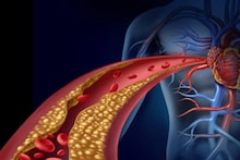 Lower Your Cholesterol: কোলেস্টেরল বাড়ায় ব্রেন হ্যামারেজ, হার্ট অ্যাটাকের ঝুঁকি, সকালের যে ৯ অভ্যাসে সায়েস্তা বেয়াড়া কোলেস্টেরল