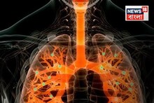 জ্বর-শ্বাসকষ্টে বিপন্ন পাঁচ বছরের শিশুর জীবন, ফুসফুসের জটিল অস্ত্রোপচারের পর ফিরল হাসি