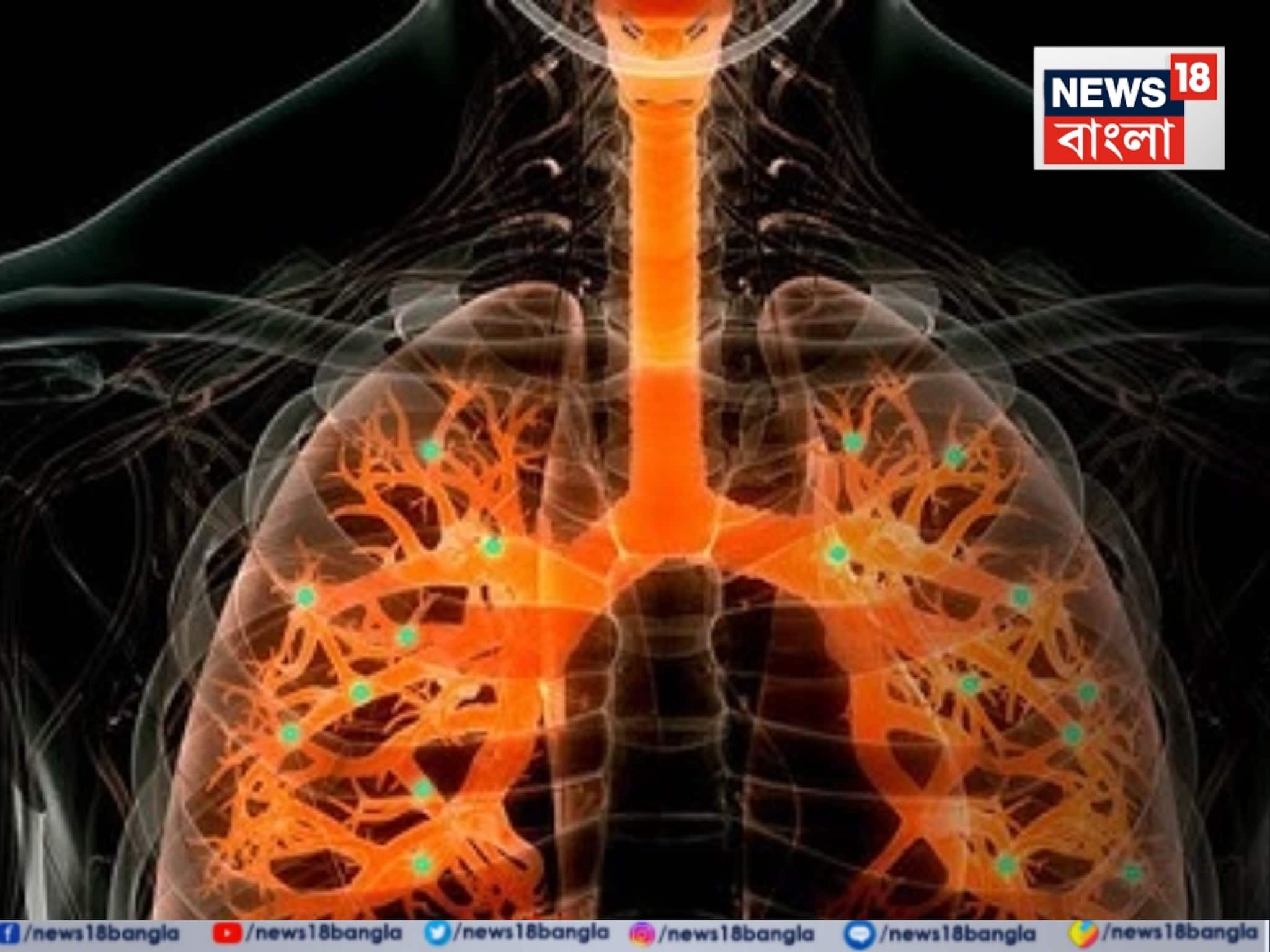 Rare Lung Disease Treatment: জ্বর-শ্বাসকষ্টে বিপন্ন পাঁচ বছরের শিশুর জীবন, ফুসফুসের জটিল অস্ত্রোপচারের পর ফিরল হাসি