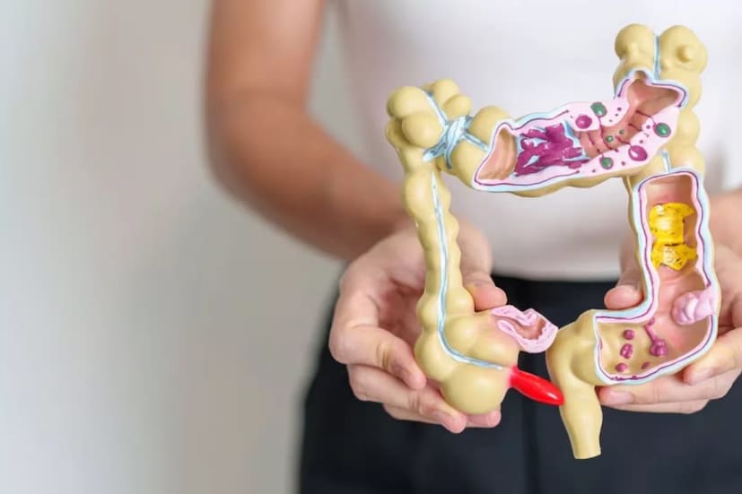 তবে এছাড়া অল্প বয়সিদের মধ্যেও দেখা দিচ্ছে কোলন ক্যানসার৷ বিশেষজ্ঞদের মত, নানা কারণে ৫০ বছর বয়সের কমেও বাড়তে পারে এই অসুখের ঝুঁকি৷ মূলত অস্বাস্থ্যকর জীবনযাপনই এর জন্য দায়ী৷