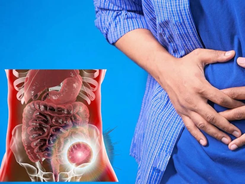 মলত্যাগের সময় রক্তপাত, ক্রমাগত ডায়রিয়া বা কোষ্ঠকাঠিন্য, পেটে ব্যথা, আচমকা ওজন কমে যাওয়া, অ্যানিমিয়া থেকে ক্লান্তির মতো লক্ষণ অবহেলা করবেন না৷