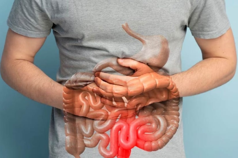 অনেক সময়েই রোগের সূত্রপাতে কোনো লক্ষণ বা উপসর্গ থাকে না৷ তাই অনেকেই বুঝতে পারেন না কোলন ক্যানসারের লক্ষণ দেখা দিয়েছে৷ ফলে চিকিৎসা শুরু হতে দেরি হলে সমস্যা ও জটিলতা বেড়ে যায়৷ বলছেন বিশেষজ্ঞ রায়ান টেলর৷