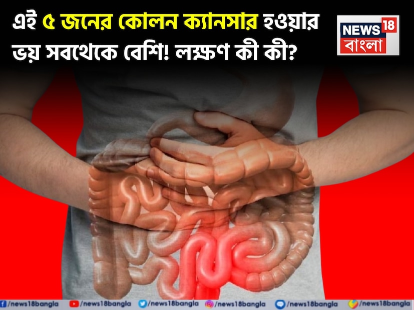 সময়ের সঙ্গে সঙ্গে বিশ্ব জুড়ে বাড়ছে কোলন ক্যানসারের প্রকোপ৷ এই রোগের হানা হচ্ছে যে কোনও বয়সেই৷ একাধিক কারণের সঙ্গে দায়ী অস্বাস্থ্যকর লাইফস্টাইল৷  সময়ের সঙ্গে সঙ্গে বিশ্ব জুড়ে বাড়ছে কোলন ক্যানসারের প্রকোপ৷ এই রোগের হানা হচ্ছে যে কোনও বয়সেই৷ একাধিক কারণের সঙ্গে দায়ী অস্বাস্থ্যকর লাইফস্টাইল৷