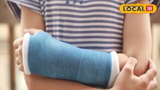 ভুল প্লাস্টারে প্রতিবন্ধী হয়ে পড়ল শিশু