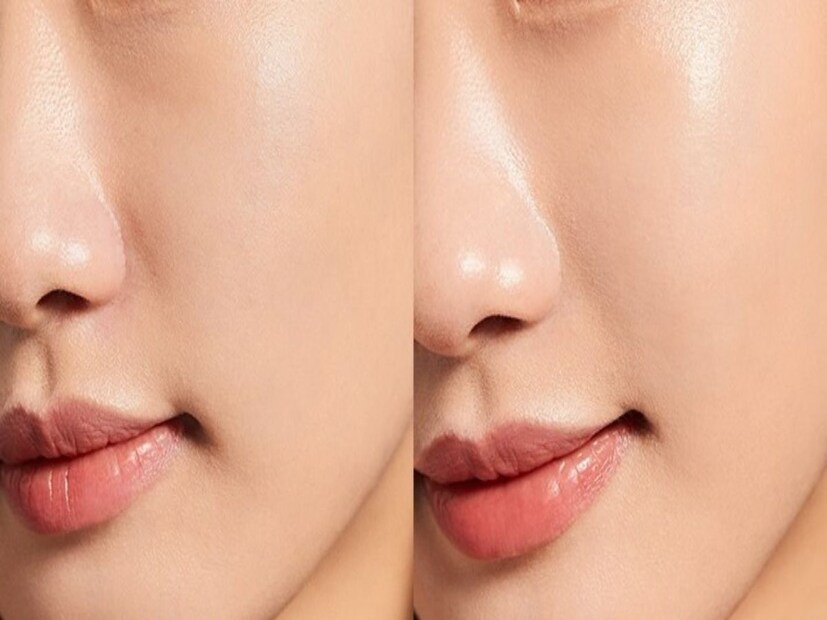 সুন্দর মুখ কে না চায়। আর তার জন্য কাঠ খড়ও কম পোড়ান না কেউ। মুখে একটু কালচে ভাব, দাগ দেখলেই অনেকে ছোটেন বিউটি পার্লার। কেউ কেউ আবার হানা দেন থেরাপিস্টের দরজায়। কোনও ছুমন্তরে যদি ফিরিয়ে আনা যায় গ্লো। সুন্দর মুখ কে না চায়। আর তার জন্য কাঠ খড়ও কম পোড়ান না কেউ। মুখে একটু কালচে ভাব, দাগ দেখলেই অনেকে ছোটেন বিউটি পার্লার। কেউ কেউ আবার হানা দেন থেরাপিস্টের দরজায়। কোনও ছুমন্তরে যদি ফিরিয়ে আনা যায় গ্লো।