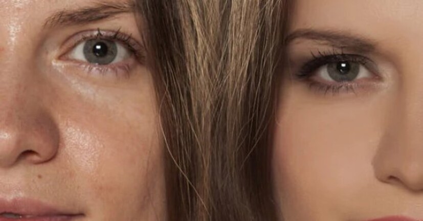 বড় ছিদ্র হয়ে যাওয়া আপনার ত্বককে রুক্ষ এবং তৈলাক্ত দেখাতে পারে। ছিদ্র সঙ্কুচিত করতে বরফের টুকরো গুরুত্বপূর্ণ ভূমিকা পালন করে। এটি আপনার ত্বককে আরও মসৃণ এবং আরও পরিশীলিত চেহারা দেয়।