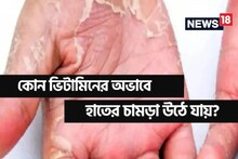 হাতে-পায়ে চামড়া উঠছে? শরীরে 'বিপদ' সংকেত! জেনে নিন কোন ভিটামিনের অভাবে এমনটা হয় 