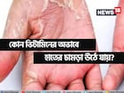 হাতে-পায়ে চামড়া উঠছে? শরীরে 'বিপদ' সংকেত! জেনে নিন কোন ভিটামিনের অভাবে এমনটা হয় 