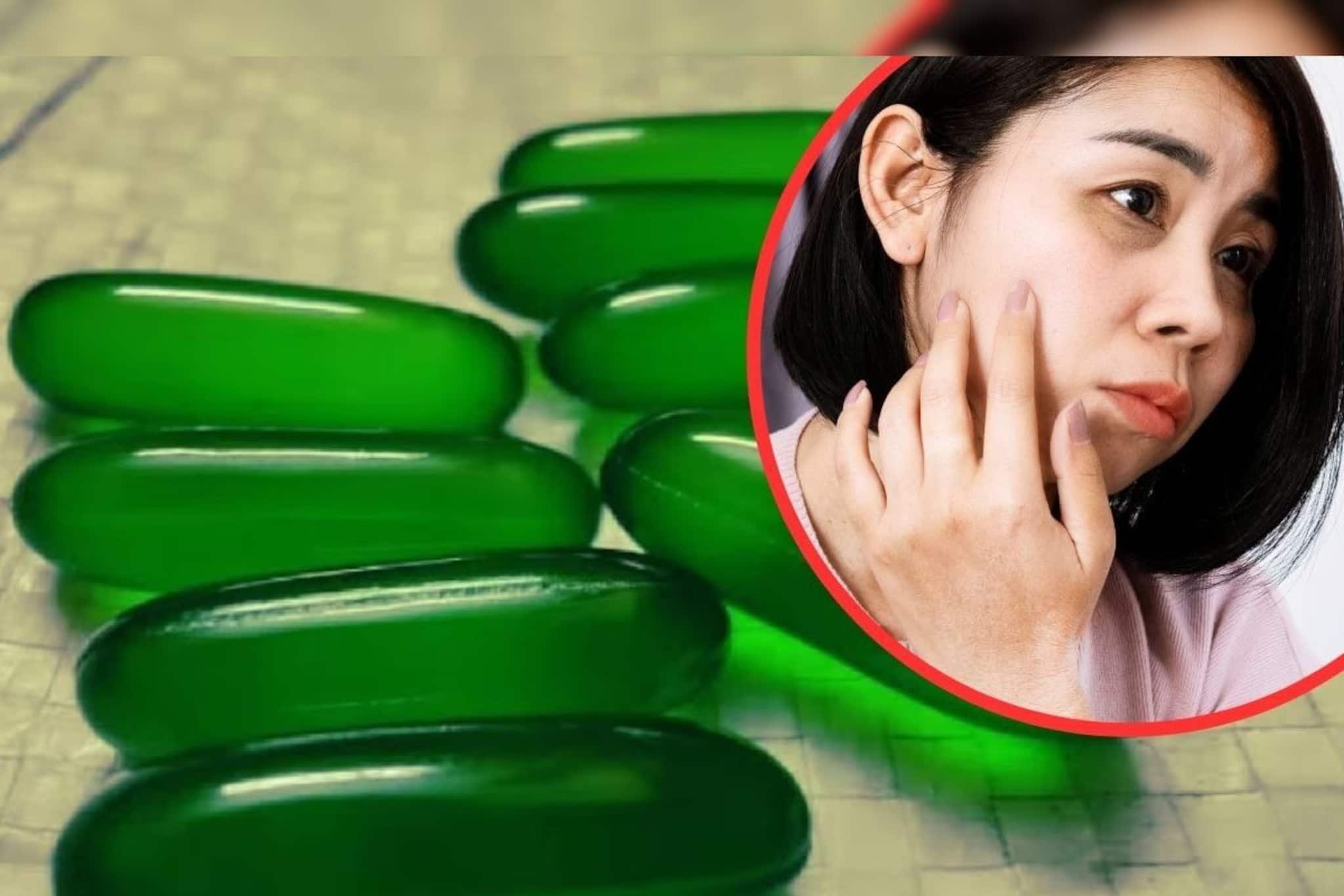 ব্রণ, ফুসকুঁড়িতে জীবন জেরবার? মুক্তি পেতে ব্যবহার করুন ঘরোয়া এই উপাদান! 'জেল্লা' ফিরবেই ব্রণ, ফুসকুঁড়িতে জীবন জেরবার? মুক্তি পেতে ব্যবহার করুন ঘরোয়া এই উপাদান! 'জেল্লা' ফিরবেই