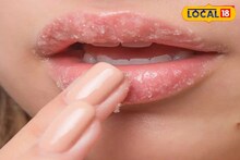 Winter Dry Lip Care: শীত এলেই ঠোঁট ফেটে চৌচির? মধু ও ঘি ব্যবহারে নরম তুলতুলে হবে ঠোঁট! জানুন বিউটিশিয়ানের টিপস