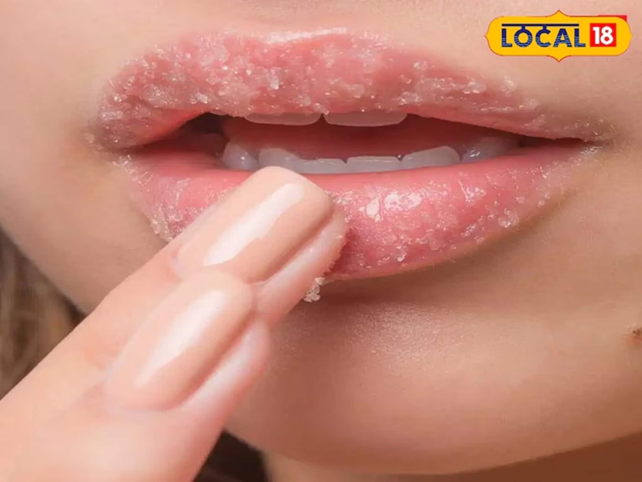 Winter Dry Lip Care: শীত এলেই ঠোঁট ফেটে চৌচির? মধু ও ঘি ব্যবহারে নরম তুলতুলে হবে ঠোঁট! জানুন বিউটিশিয়ানের টিপস