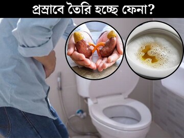 প্রস্রাবে তৈরি হচ্ছে ফেনা! শরীরে বাসা বাঁধছে কোন মারাত্মক রোগ? লক্ষণ দেখলেই সতর্ক হন