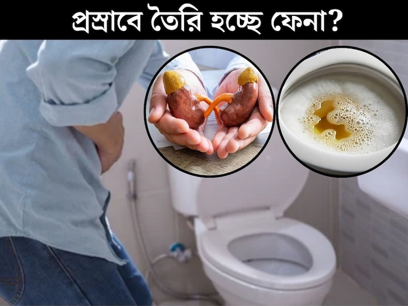 শরীরে যখন কোনও বড় রোগ বাসা বাঁধে, তা লক্ষণের মাধ&#x200d;্যমে বিভিন্নভাবে জানান দেয় দেহের নিজস্ব ‘ইন্টেলিজেন্স’। শরীরের বাহ&#x200d;্যিক অঙ্গে, রেচন পদার্থে দেখা যায় বিভিন্ন লক্ষণ। ডাক্তারি পরিভাষায় যাকে বলে সিম্পটম্পস। 