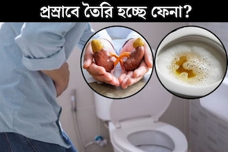 প্রস্রাবে তৈরি হচ্ছে ফেনা! শরীরে বাসা বাঁধছে কোন মারাত্মক রোগ? লক্ষণ দেখলেই সতর্ক হন