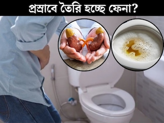 প্রস্রাবে তৈরি হচ্ছে ফেনা! শরীরে বাসা বাঁধছে কোন মারাত্মক রোগ? লক্ষণ দেখলেই সতর্ক হন