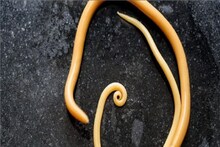 Roundworm Infection: ইনটেস্টাইনে ডিম পারে রাউন্ডওয়ার্ম, সেখান থেকে ফুসফুস, ব্রেন,হতে পারে নিউমোনিয়াও! লবঙ্গ, গাজরের মতো ৭ সাধারণ খাবারেই জব্দ কৃমির দল