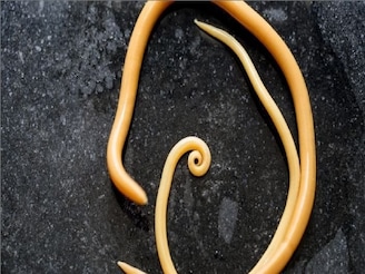 ইনটেস্টাইনে ডিম পারে রাউন্ডওয়ার্ম, লবঙ্গ, গাজরের মতো ৭ সাধারণ খাবারেই জব্দ কৃমির দল