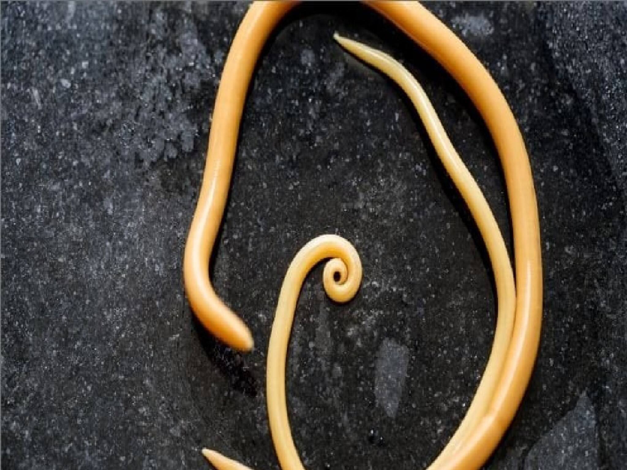 Roundworm Infection: ইনটেস্টাইনে ডিম পারে রাউন্ডওয়ার্ম, সেখান থেকে ফুসফুস, ব্রেন,হতে পারে নিউমোনিয়াও! লবঙ্গ, গাজরের মতো ৭ সাধারণ খাবারেই জব্দ কৃমির দল
