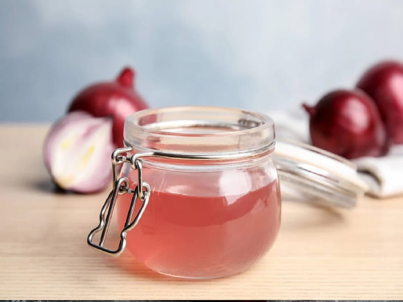 কীভাবে ব্যবহার করবেন? একটি পেঁয়াজ ব্লেন্ড বা কুঁচি করে রস বার করে নিন। ২ টেবিলচামচ পেঁয়াজের রসের সঙ্গে ২ টেবিলচামচ নারকেল তেল মিশিয়ে নিন। যেখানে চুল পড়ছে, সেখানে এই তেল ভালভাবে মালিশ করুন, ৩০ মিনিট রেখে দিন, তার পর হালকা শ্যাম্পু দিয়ে ধুয়ে ফেলুন। সপ্তাহে ২-৩ বার এই তেল ব্যবহার করুন।