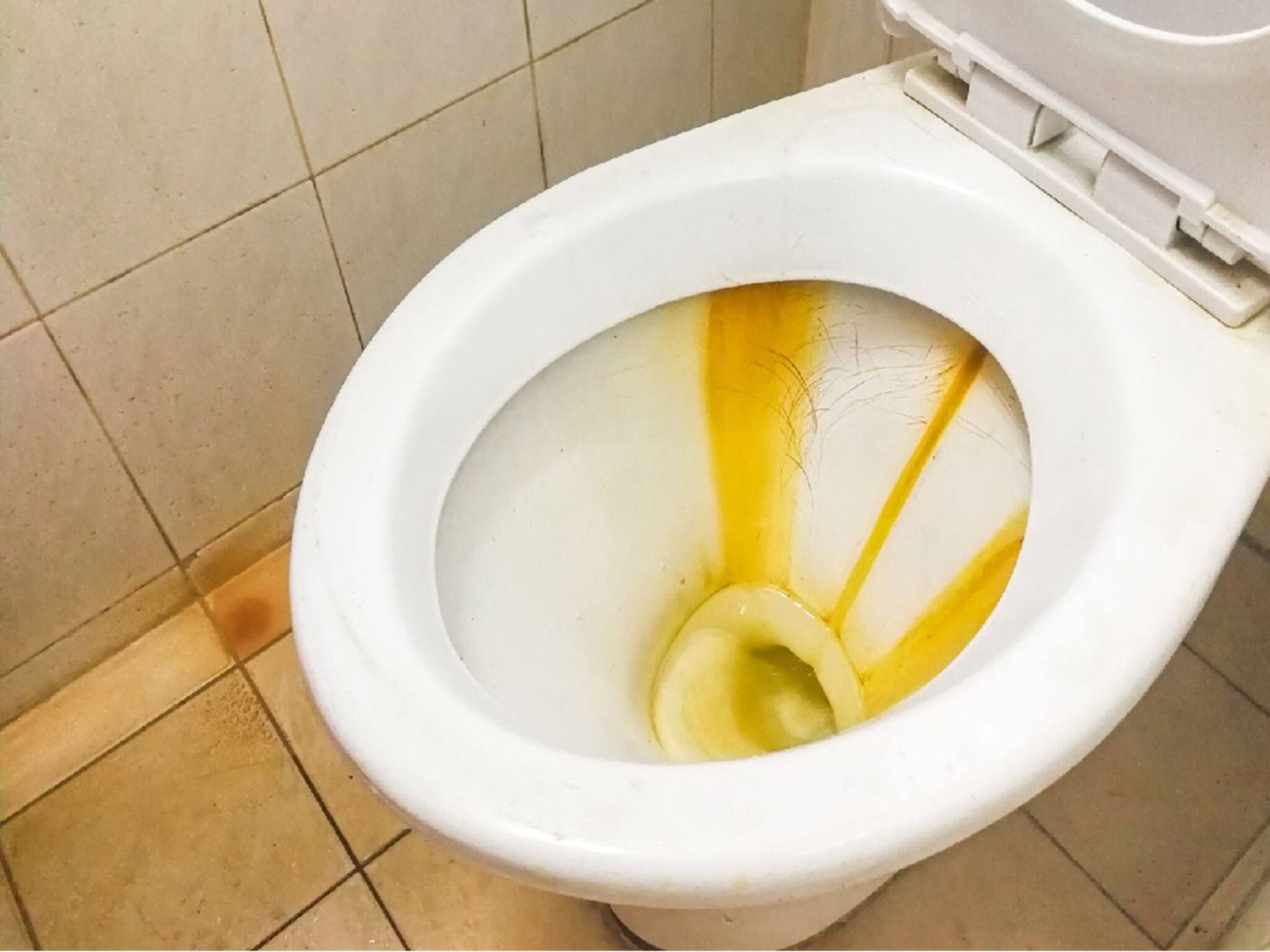 Cleaning Tips: গাদাগাদা খরচ করে ক্লিনার নয়,কমোডের নোংরা দাগছোপ দূর হবে বাড়িতে থাকা লেবুর রসের মতো ৩ সহজ জিনিসেই, নতুনের মতো ঝকঝকে পুরনো কমোড